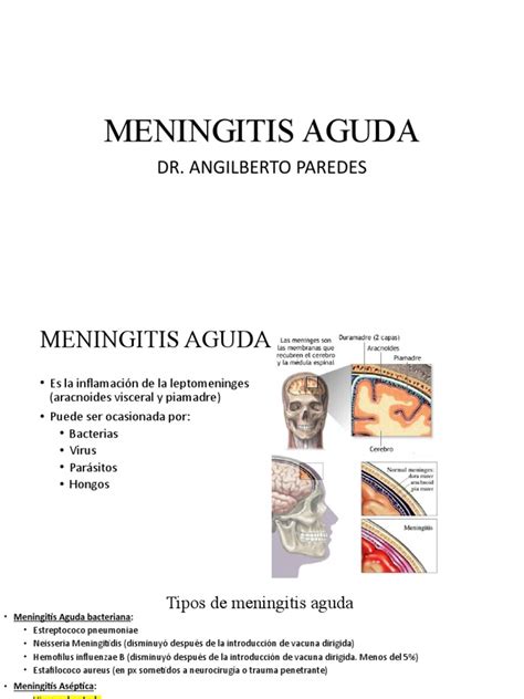 meningitis aguda - cid dor aguda
